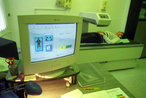 Október 20.: A csontritkulás nemzetközi napja