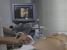 A Belügyminisztérium lapja szerint az Országos Bábaszövetség is jóváhagyta az abortuszmódosítást 