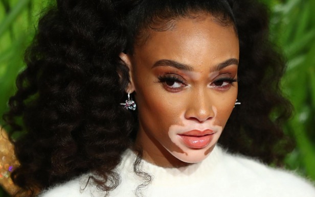 Június 25.: Vitiligo világnapja, a Barlangok napja, a Tengerész világnap és a Rendszergazdák világnapja