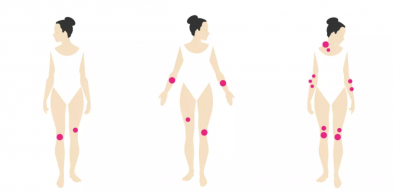 Pikkelysömör - induljon el róla a párbeszéd!