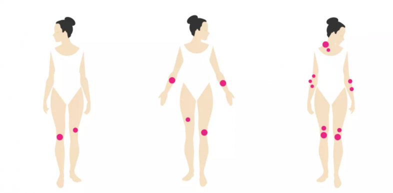 Pikkelysömör - induljon el róla a párbeszéd!