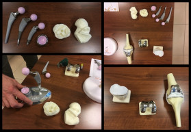 Túlsúlyos emberek bizonyos műtéteknél még a várólistára sem kerülhetnek fel