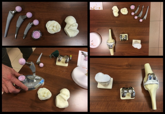 Túlsúlyos emberek bizonyos műtéteknél még a várólistára sem kerülhetnek fel