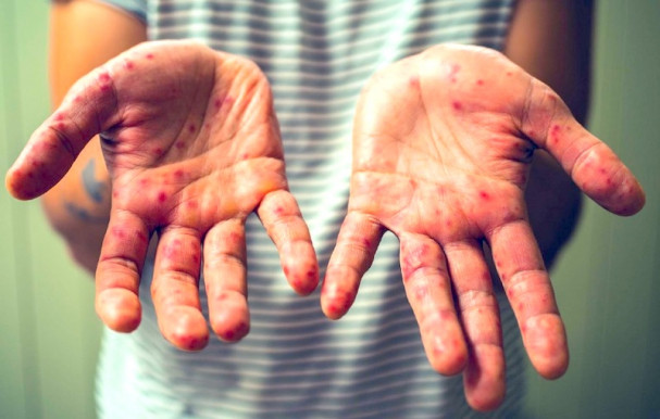 Kanyaróparti mint új divat