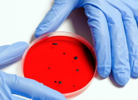 Amerikai és magyar kutatók a génrendszer felől támadják a koronavírust