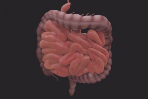 Korai felismeréssel a vastagbélrák ellen