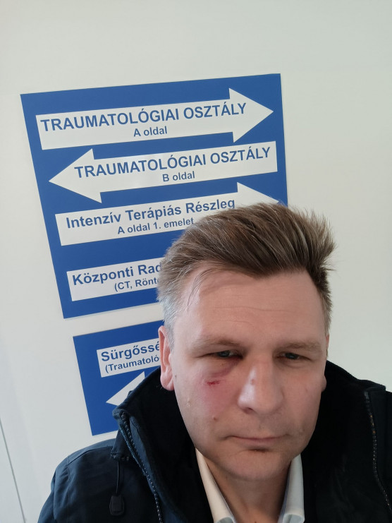 Leütötte az egyik ellenzéki jelöltet egy DK-képviselő Dobrev fórumán