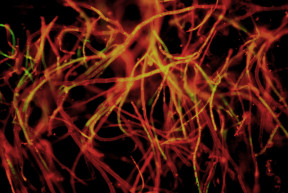 Evolúciós hullámvasút