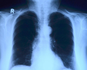 Öngyilkos társadalom vagyunk - Kárpáti Iván jegyzete