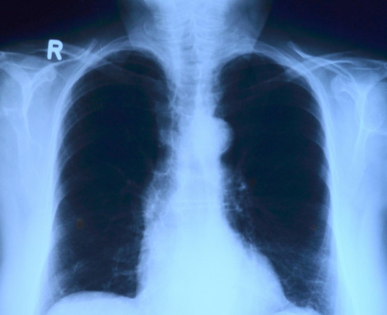 Öngyilkos társadalom vagyunk - Kárpáti Iván jegyzete