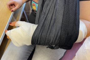 A csuklótörött, aki evett – Selmeci János jegyzete