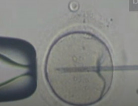 Akinek két anyja van – a háromszülős eljárás