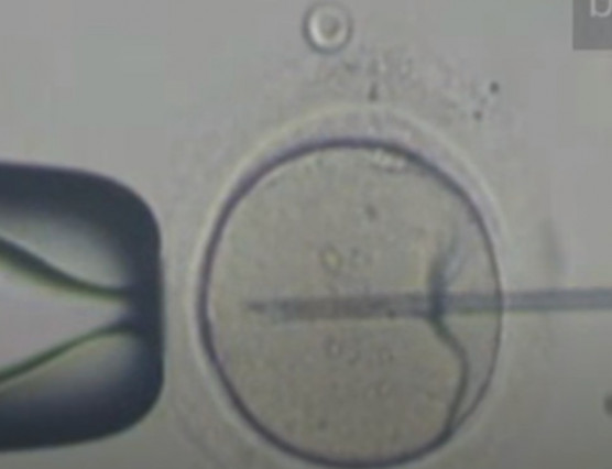 Akinek két anyja van – a háromszülős eljárás