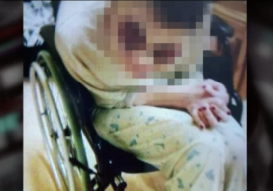 RTL: Évek óta rendszeresen verik a fogyatékosságal élőket egy veszprémi szociális otthonban