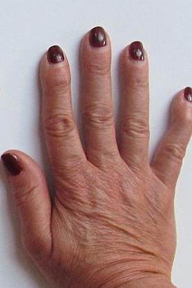 Ujjaival lövöldözve térítette el unokáit a kütyüktől